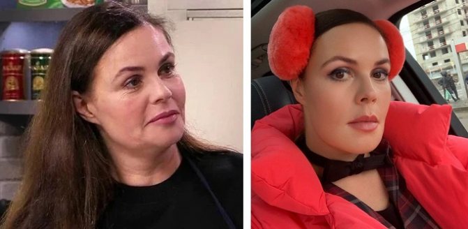 На фото Екатерина Андреева до и после пластики?